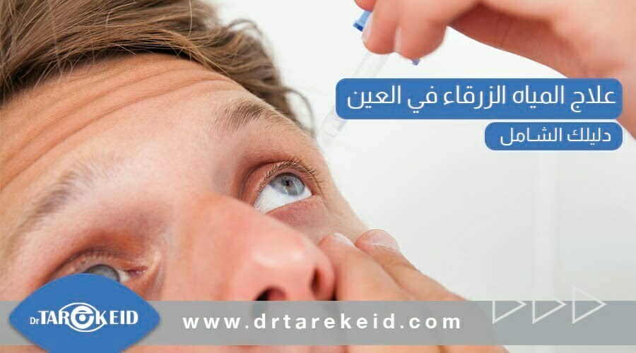 تشخيص وعلاج مرض المياه الزرقاء في العين